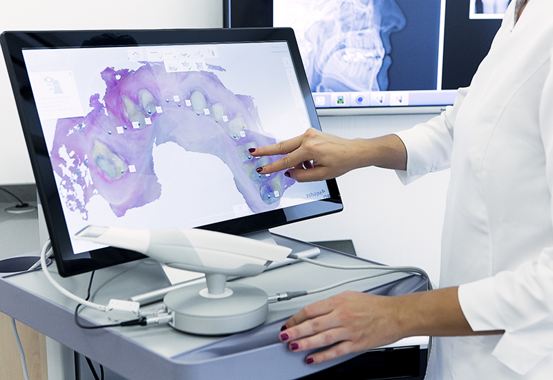 Dentist looking at a screen showing a digital model of an arch of teeth