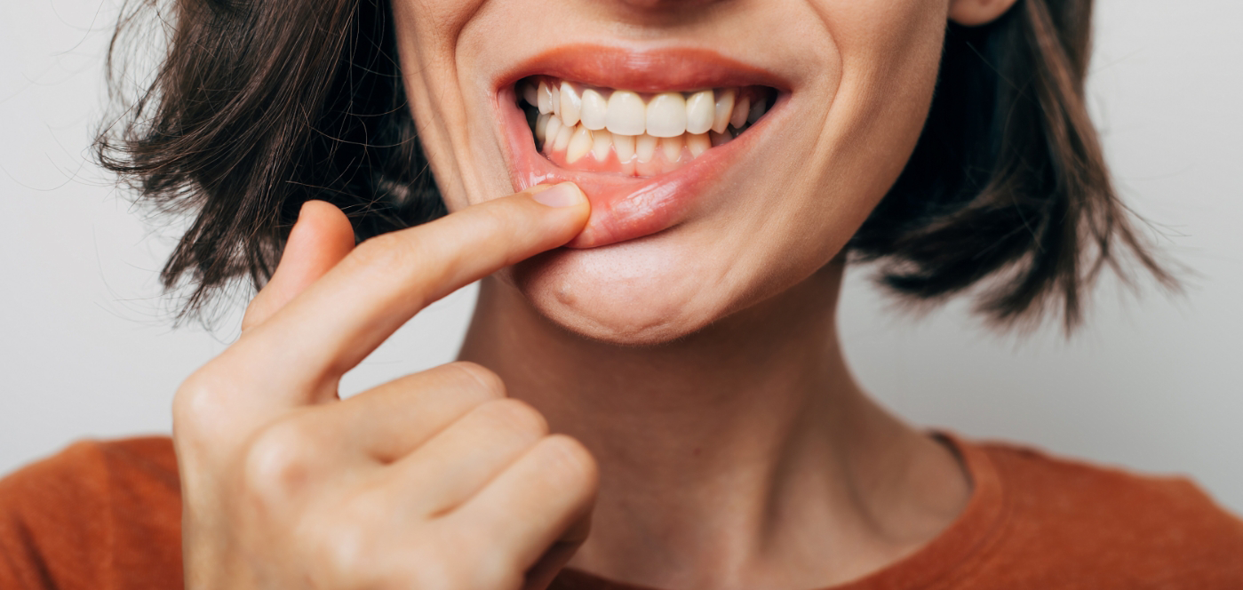 Close up of a person pointing to their gums before gum disease treatment in Wauwatosa