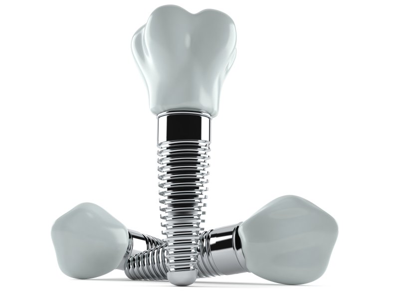 dental implants